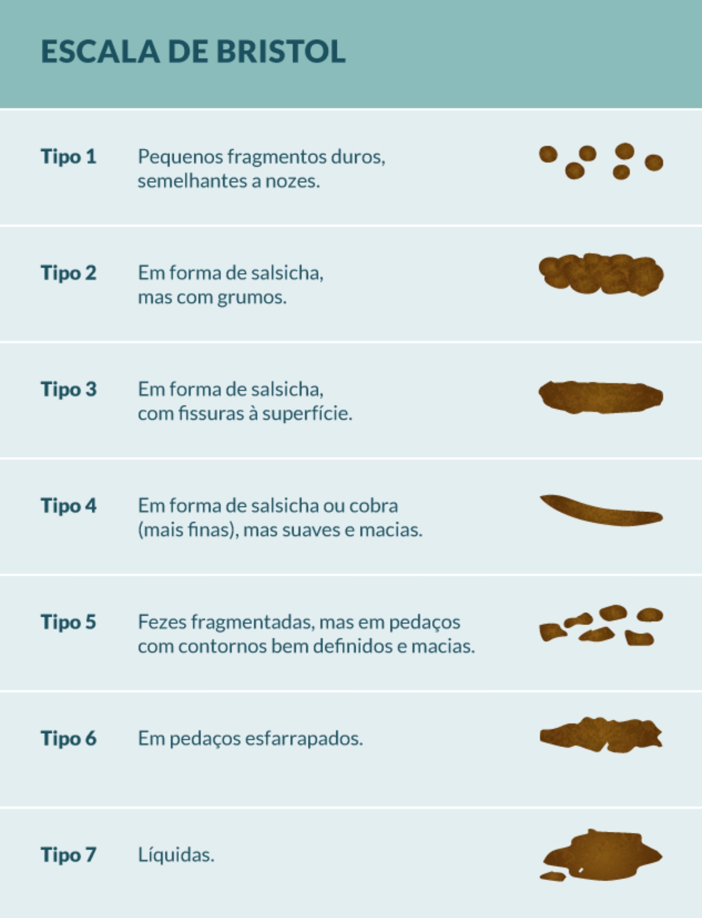 Síndrome do Intestino Irritável – quais são os tipos?
