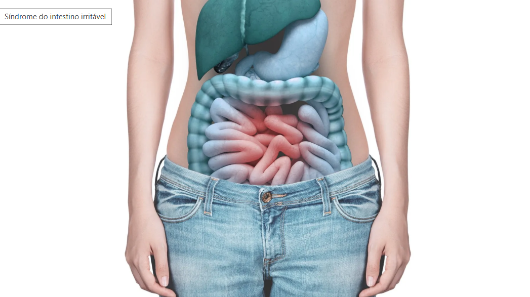 Síndrome do Intestino Irritável – não consegue ganhar/perder peso?